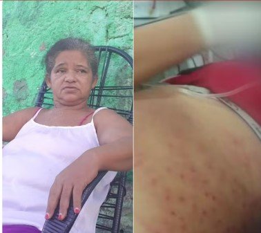 Mulher que levou 1,5 mil picadas de abelhas na Grande Natal deixa hospital após quase um mês: ‘Voltar para minha família’