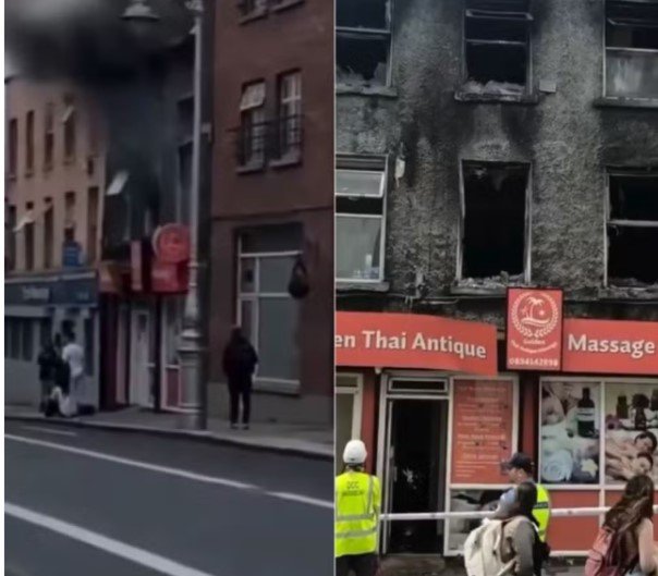 Potiguar fica em estado grave após incêndio em prédio na Irlanda