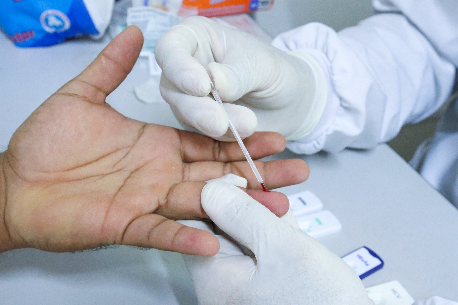 Parnamirim disponibiliza testes rápidos para sífilis, HIV e hepatites em todas as UBSs