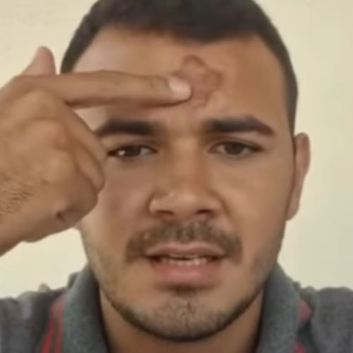 Fiéis relatam queimaduras na testa após receber sinal da cruz com cinzas em missa no RN